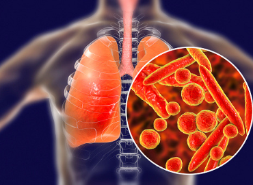 Mycoplasma Pneumonia