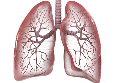Other Kinds of Pneumonia